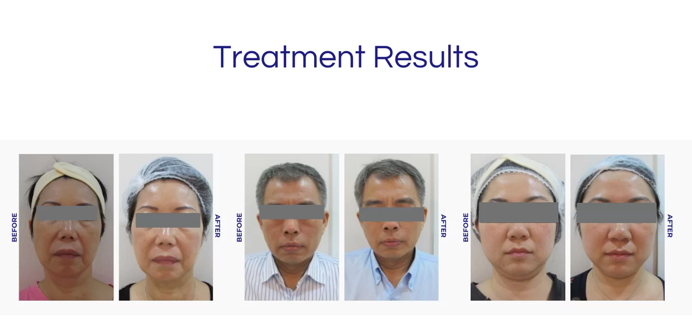 Arbeaute Result 1