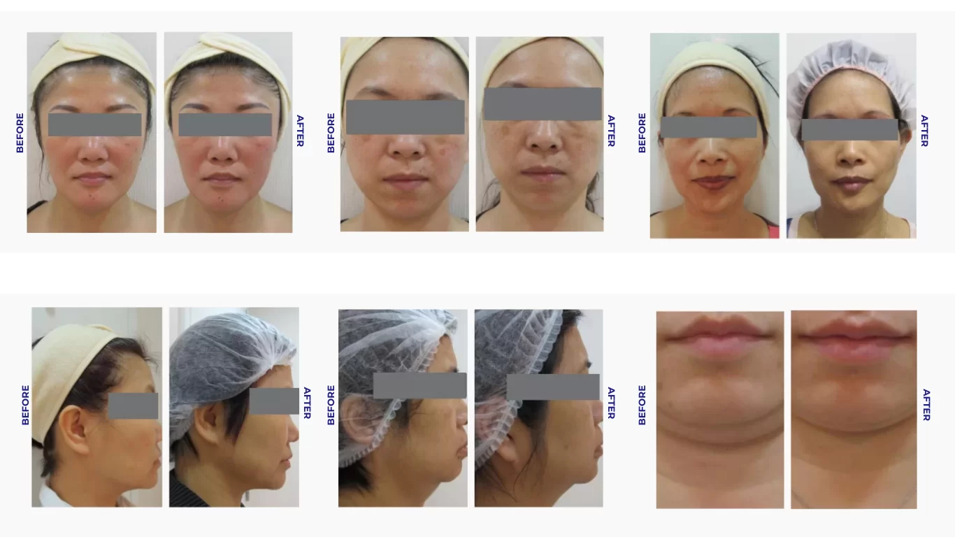 Arbeaute Result 2